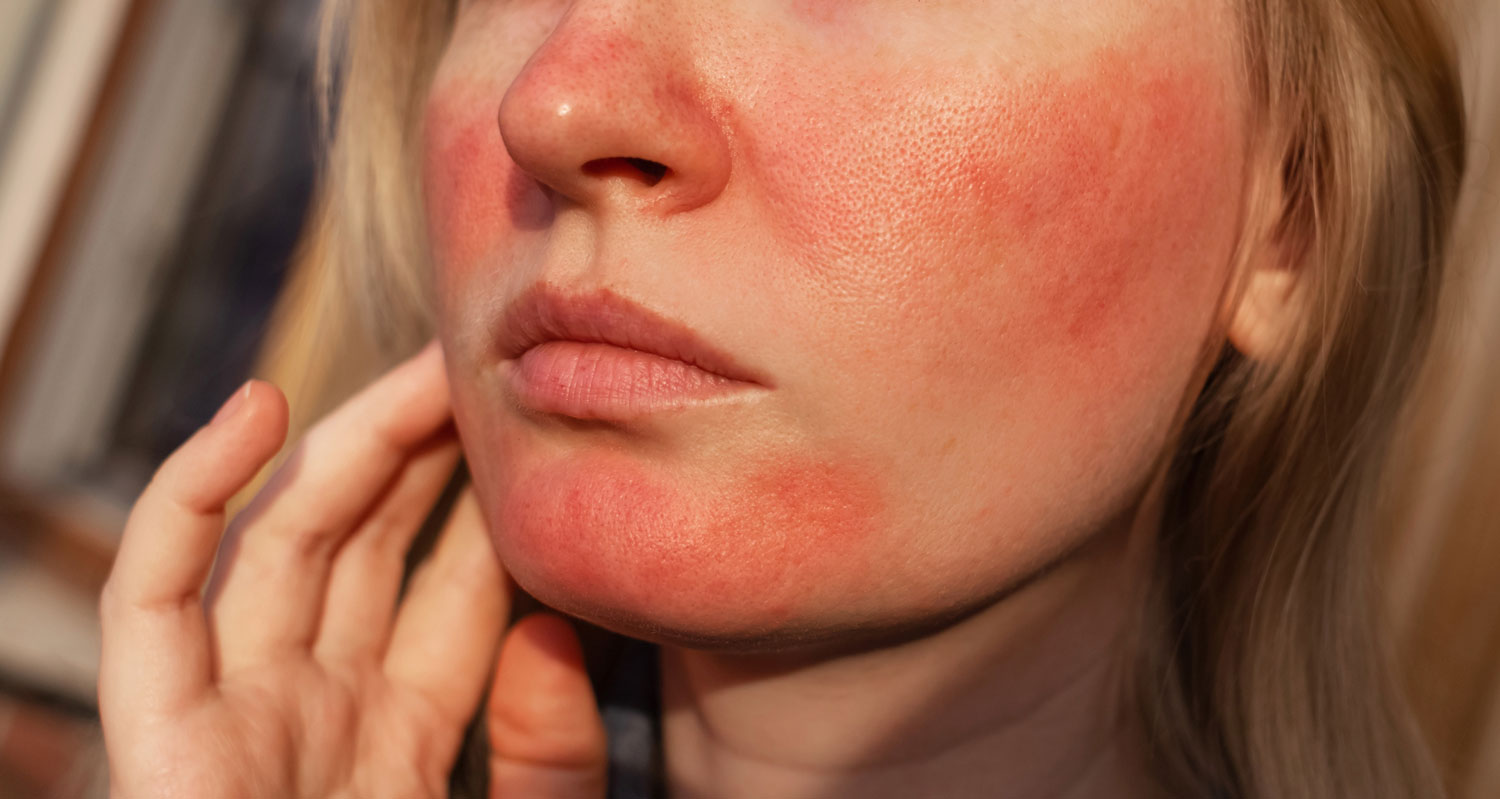 Pariser dermatologist examining a patient's facial skin