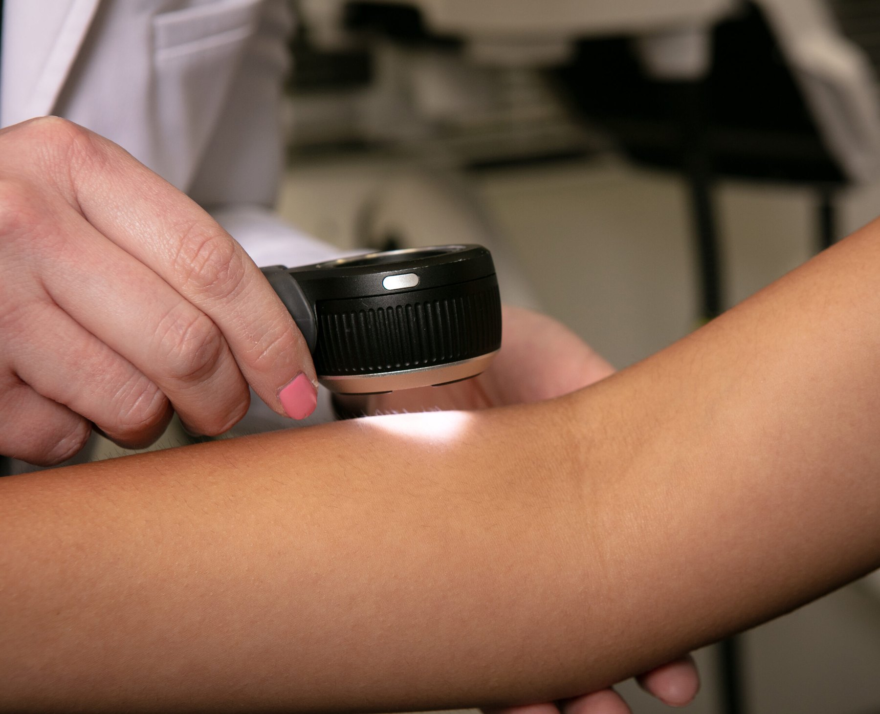 Pariser dermatologist examining a patient's skin with a dermatoscope